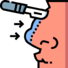 rhinoplasty rhinoplasty
