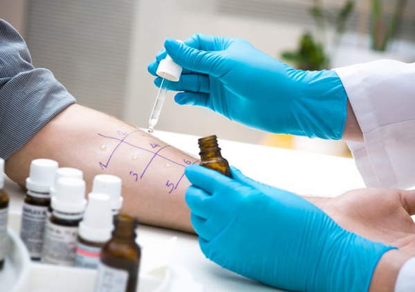 skin-prick-allergen