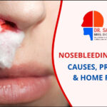 Nose bleeding in summer